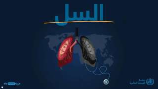 الصحة العالمية تكشف عن ”أخطر الأمراض المعدية فتكا” في العالم